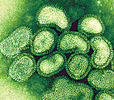 schweinegrippe viren